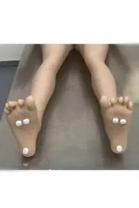 Standing-Feet-Screw-Caps.jpg.webp